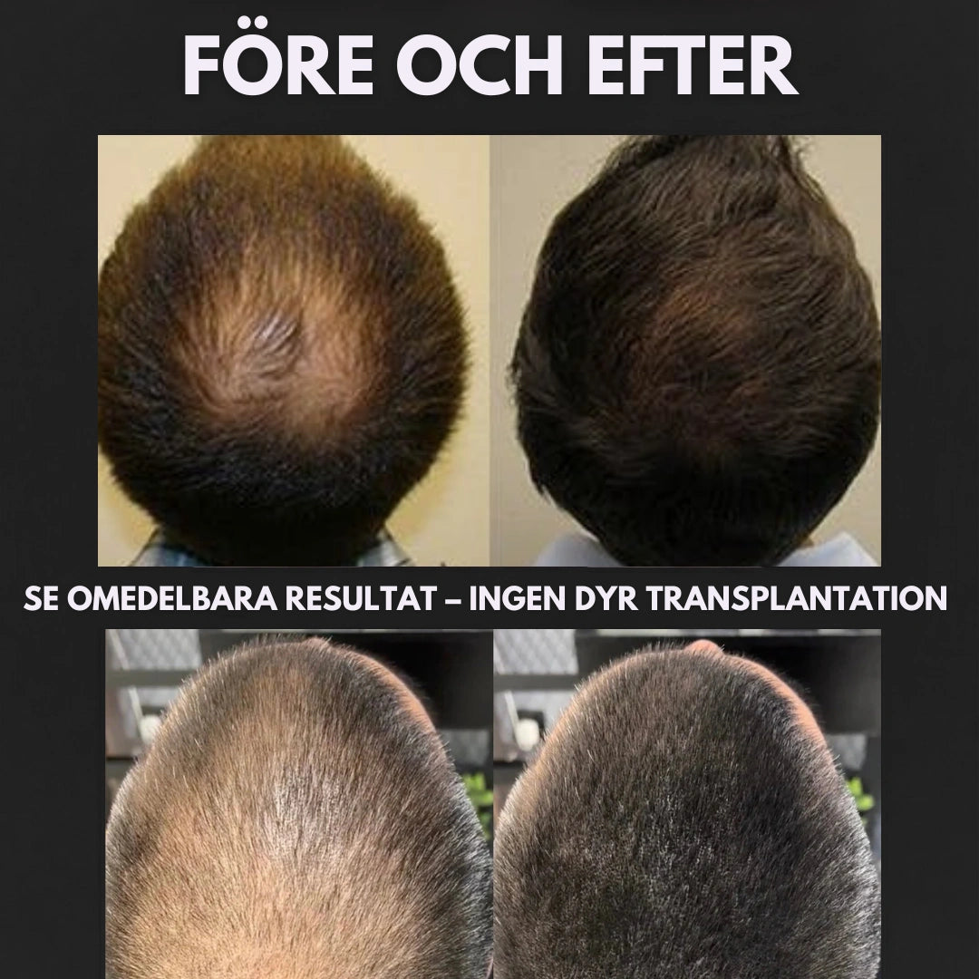 Masculine HairRich™ - Premium Hairloss Filler For Men